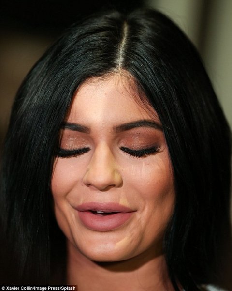 Surgery hedhumeethee miothee umurah hithaama kuran jehifai: Kylie