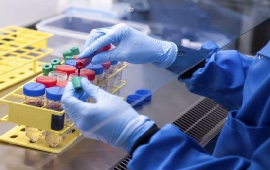 Serum in Astrazeneca vaccine ge 40 million doze ufahdhaifi