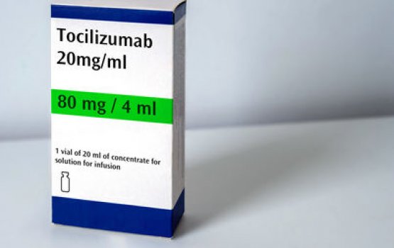 Arthritis ge beyhakun covid maru madhukureveykan science verin hoadhaifi