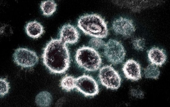 Covid -19 ge test kuran aa ukulheh singapore in eejaadhu koffi