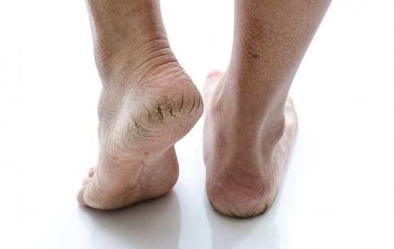 Funnaabu falhaigen dhaneetha? Halleh beynuntha?