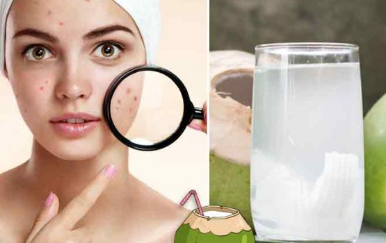 Kurunba fen: hamuge reethikan ithuru kohdhey