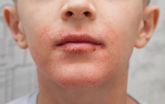 Moonuge hangandu kuraku veytha?