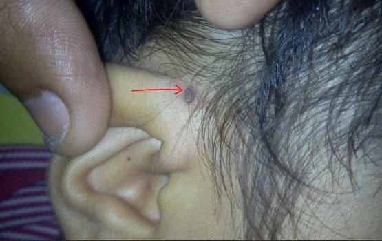 Sellhi roaga ah samaaluvumah Dr. Faisal ilthimaaskoffi