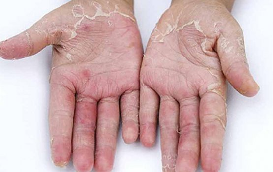 Gain han folheytha? Miothee halleh!