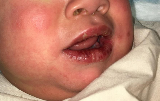 Covid jehey kudakudhinge gain Misk fennanee