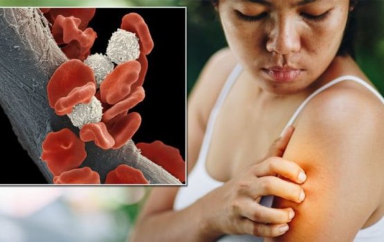 Samaalu vey! Mi ee leyge cancer ge alaamaaiy thakakah vedhaane!