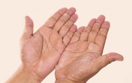 Athun han folheneetha? Miothee thikamuge hallu!