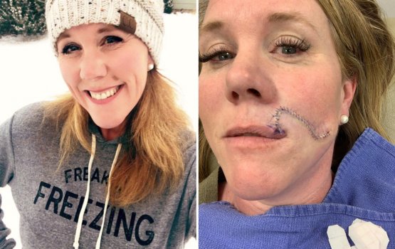 Aadhaige ufan lafeh kamah heekuri lafu vee nurahkaatheri cancer ehge nishaanakah!