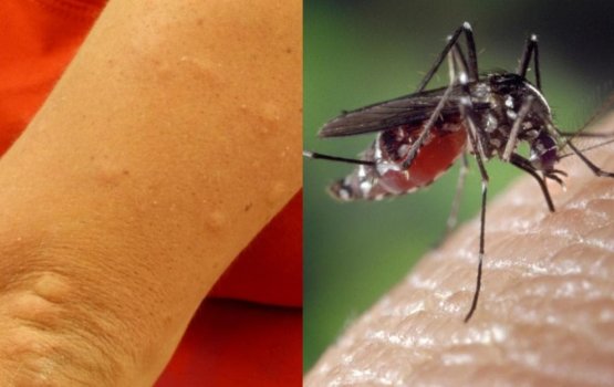 Midhiri bissah geygai dhevidhaane faruvaa thakeh!