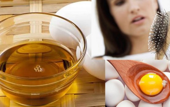 Miothee bolun isthashi faibaa nama geygai hadhaalevidhaane treatment thakeh!