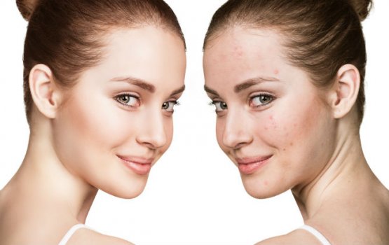 Omaan moonakah mi keunthah khiyaaru kurey!