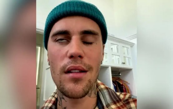 Mashooru lavakiyuntheriya Justinge moonuge effaraai paralyze vejje 