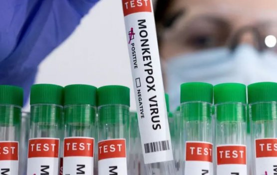 Monkey pox aa eku mulhi dhuniyeygai sihhee kulli haalathu iulaan kohfi