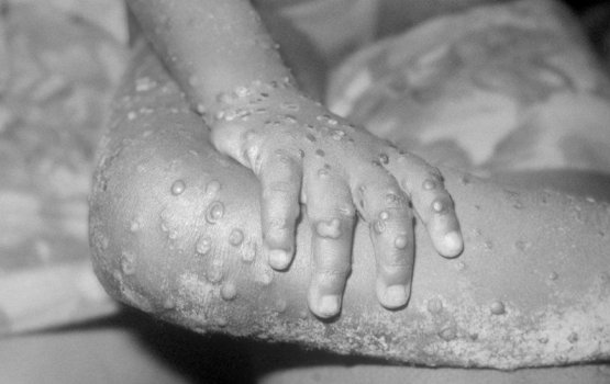 Rajje in Makunu vidhuri ah shakku kurevey meehaku test kurany