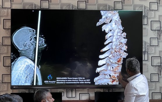 Moonah dhagandu herunu meehaage furaana salaamai vee 9 gadi iruge surgery akah fahu