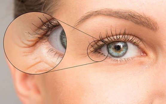 Loa kaireegai roo hureytha? Miothee hallu!