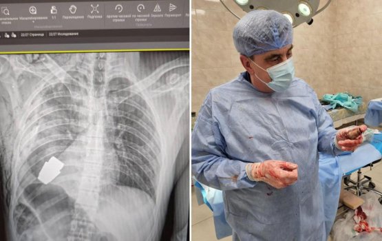 Ukraine sifain ge meehegge meitherein athu bomeh nagaifi