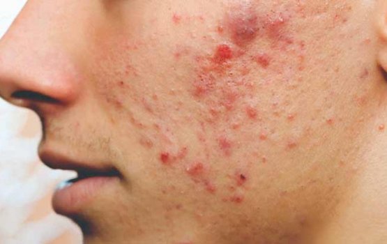 Moonun oshaalha naganee mihenve kamah vedhaane!