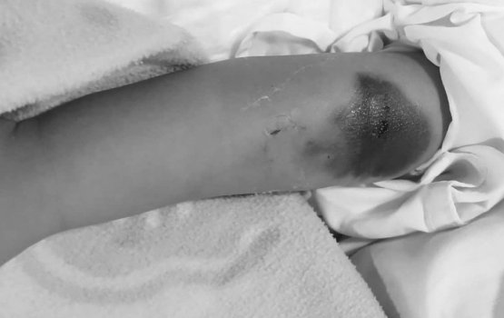 Kulhudhuffushi Hospital in kuda kujjehge faruvaagai 'ihumaaluvee' massala balanee