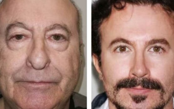 Turkey gai plastic surgery hadhaigen meehaku zuvaan kollaifi