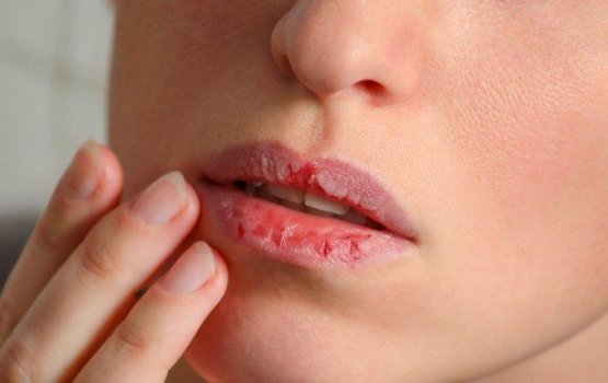 Thunfaiy falhaigen dhanee mihenve!