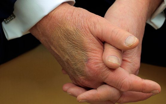 Trumpge athun fenunu sirru nishan akun aammun haaskamah