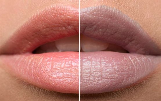 Thunfaiy kalhu vumah avas halleh beynun tha?