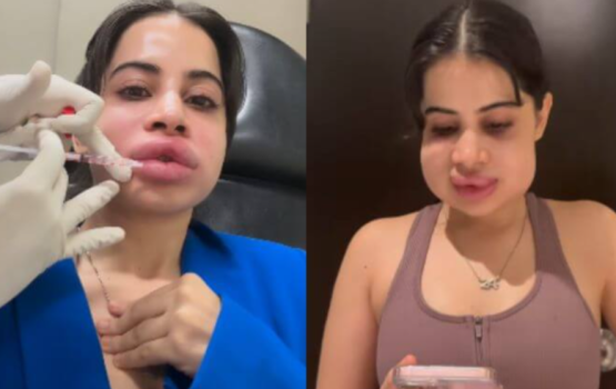 Urfi ge moonah ai badhalaaeku fan in sihijje