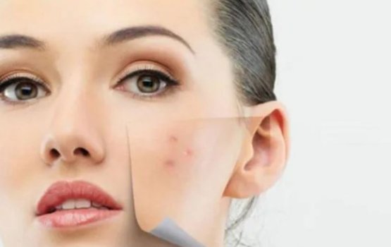 Moonun nufilaa bihi thakaai eyge sababu!