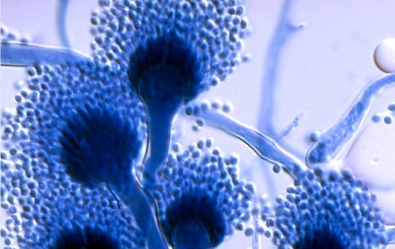 Sandhoakuge roohaanee baareh canceruge faurvaa akah ?