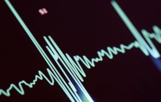 Hithuge baleege nurahkaa othee firihenunnah ekani tha?