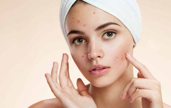 Moonun oshaalha bihi nagaanama samaalu vaan vee dhethin kameh!