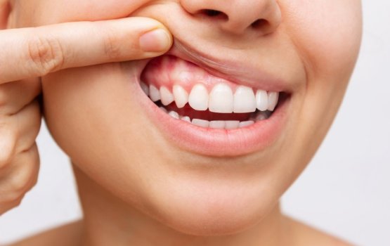 Hirugan'du ge dhulhaheyo kamah samaalu vaan jehenee mihenve!