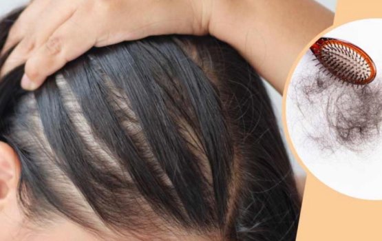 Isthashigandu maa bodah thunive balikashi vanee mihenve kamah vedhaane!