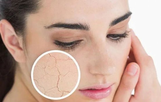 Moonuge han hikeynama mi ufehdhun thah beynun nukuraathi!