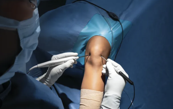 Raajjey gai mulhin alah 'Nano Needle' beynun koigen surgery thah kuran fashaifi 